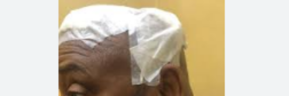 Man accused of chopping St. Ann’s Bay Mayor Micheal Belnavis last year offered bail while trial set for July