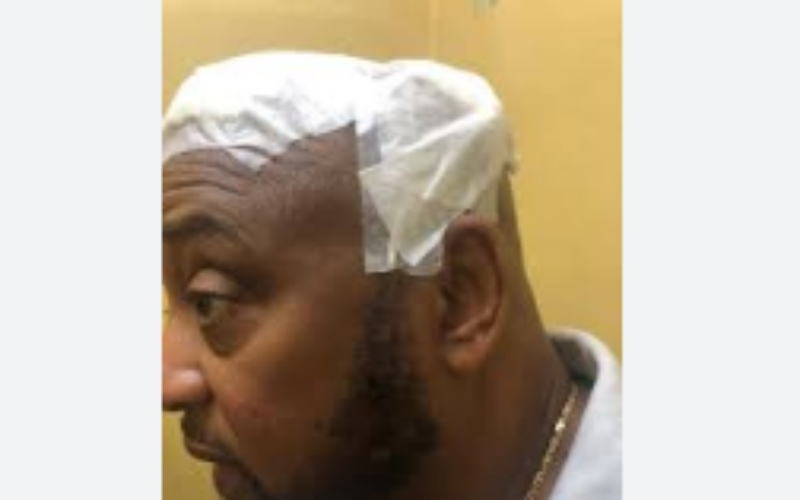 Man accused of chopping St. Ann’s Bay Mayor Micheal Belnavis last year offered bail while trial set for July